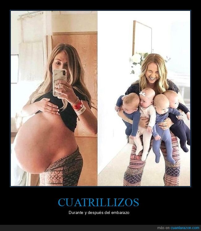 cuatrillizos,embarazo,bebés