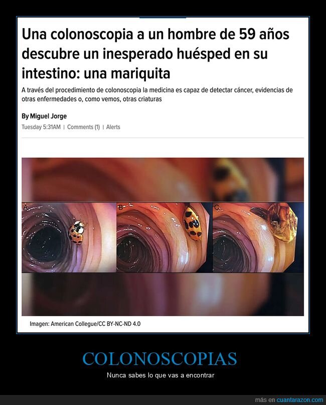 colonoscopia,mariquita,wtf