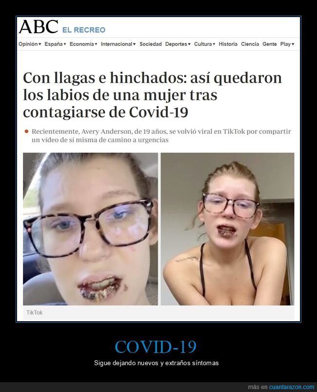 labios,covid,llagas,wtf