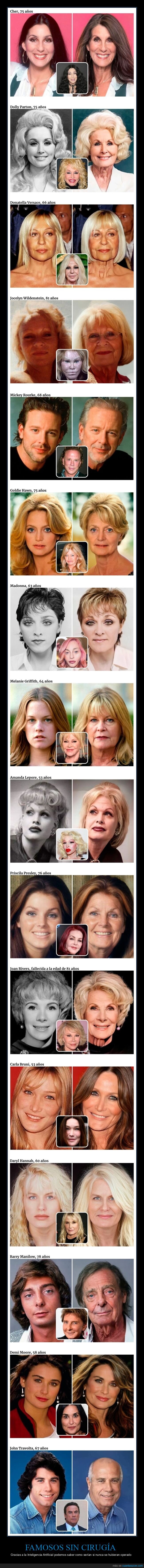 famosos,cirug&iacute;a,operaciones