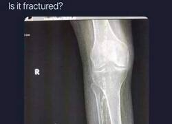 Enlace a Una tirita y para casa