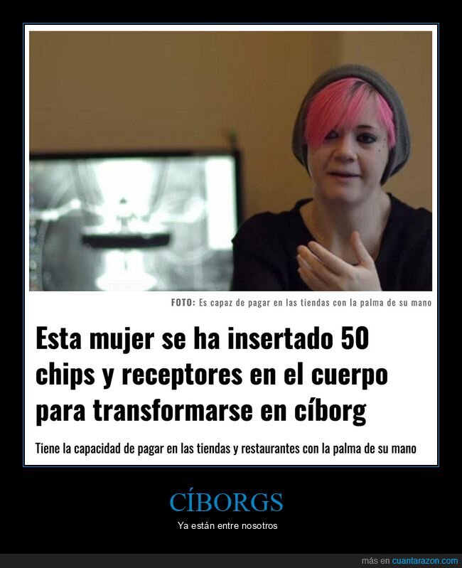 chips,c&iacute;borg,implantes