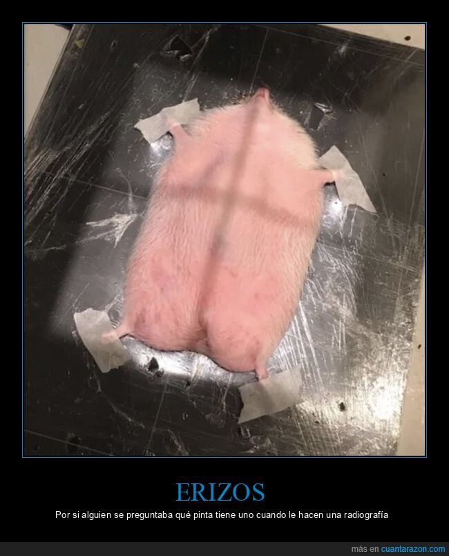 erizo,radiograf&iacute;a,curiosidades