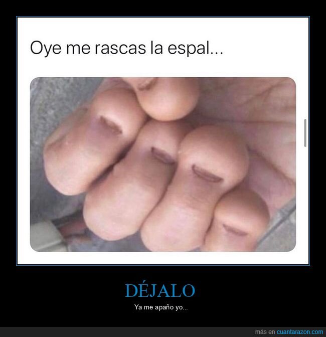 espalda,rascar,uñas,wtf