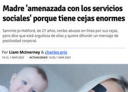Enlace a Cejas problemáticas