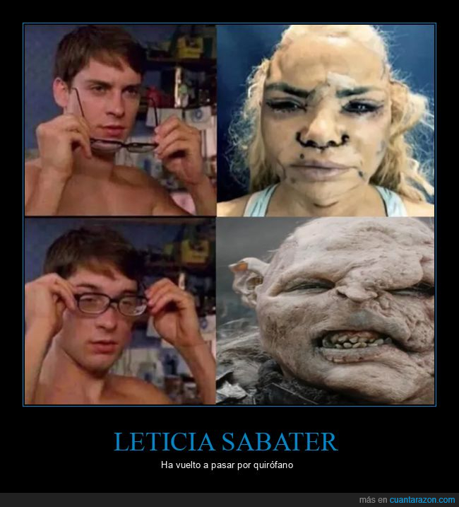 cirugía,leticia sabater,wtf