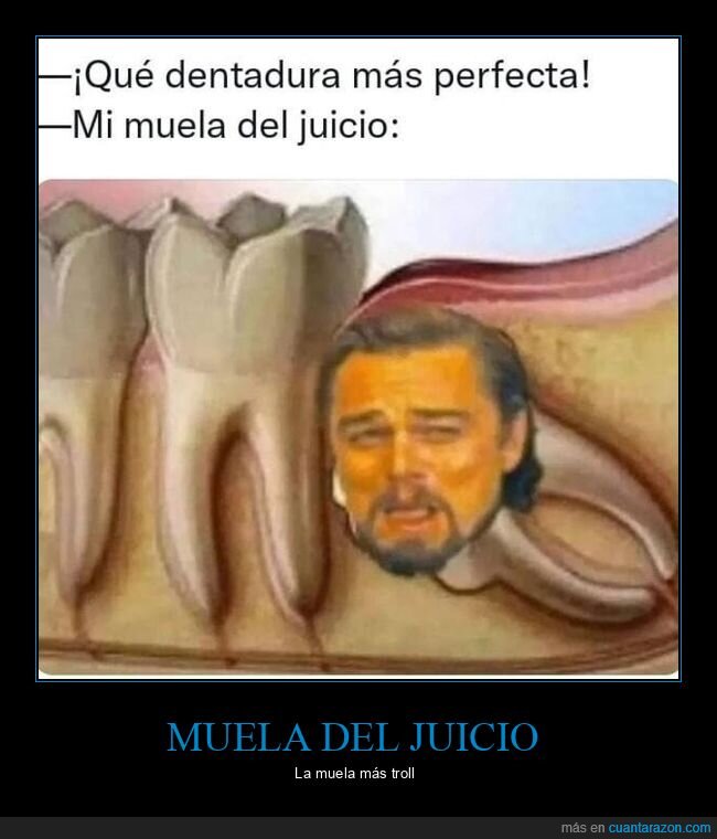 dentadura,muela del juicio