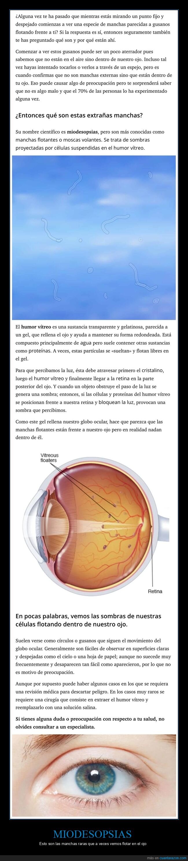 miodesopsias,manchas,ojo,curiosidades