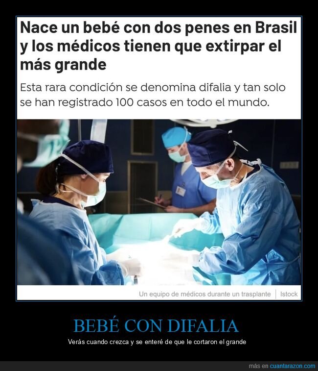 bebé,difalia,cortar,grande