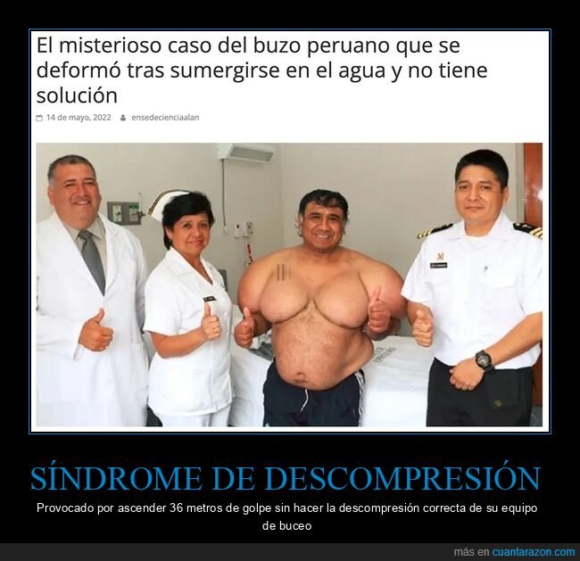 buzo,cuerpo,deformado,descompresión,wtf