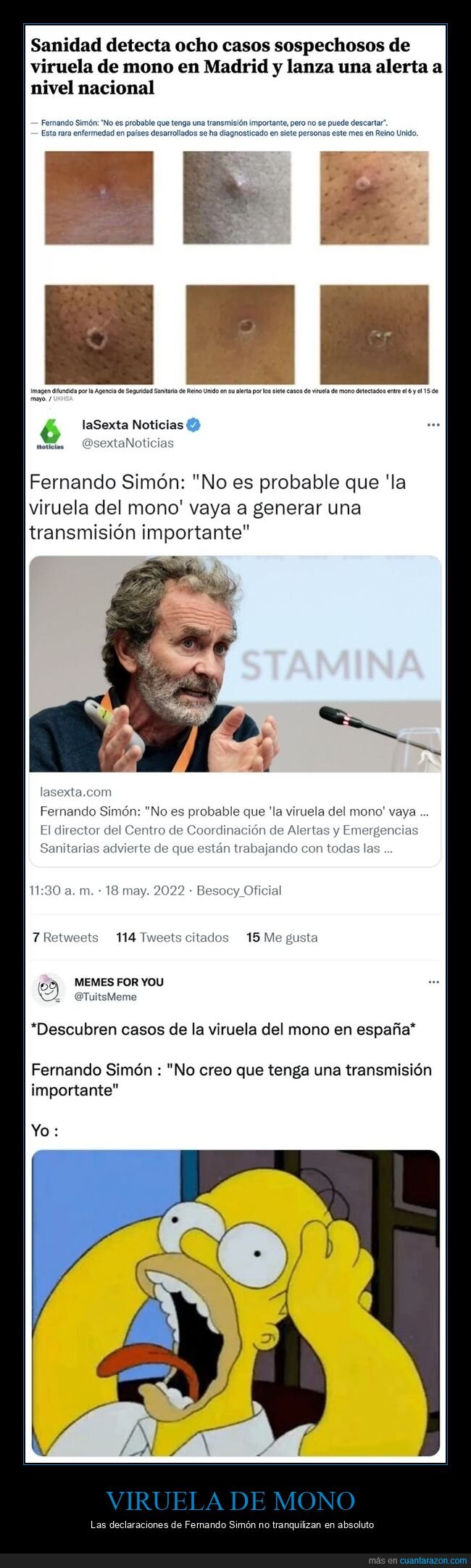 aportes,fernando simón,¡¡,viruela del mono