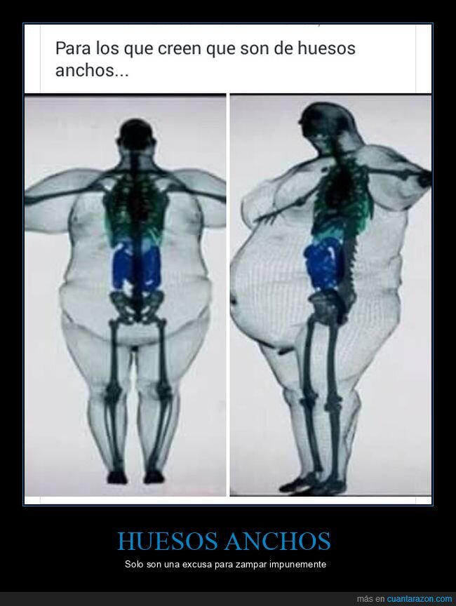 esqueleto,gordo,huesos anchos