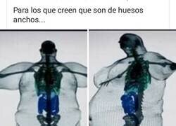 Enlace a Lo ancho no son los huesos...