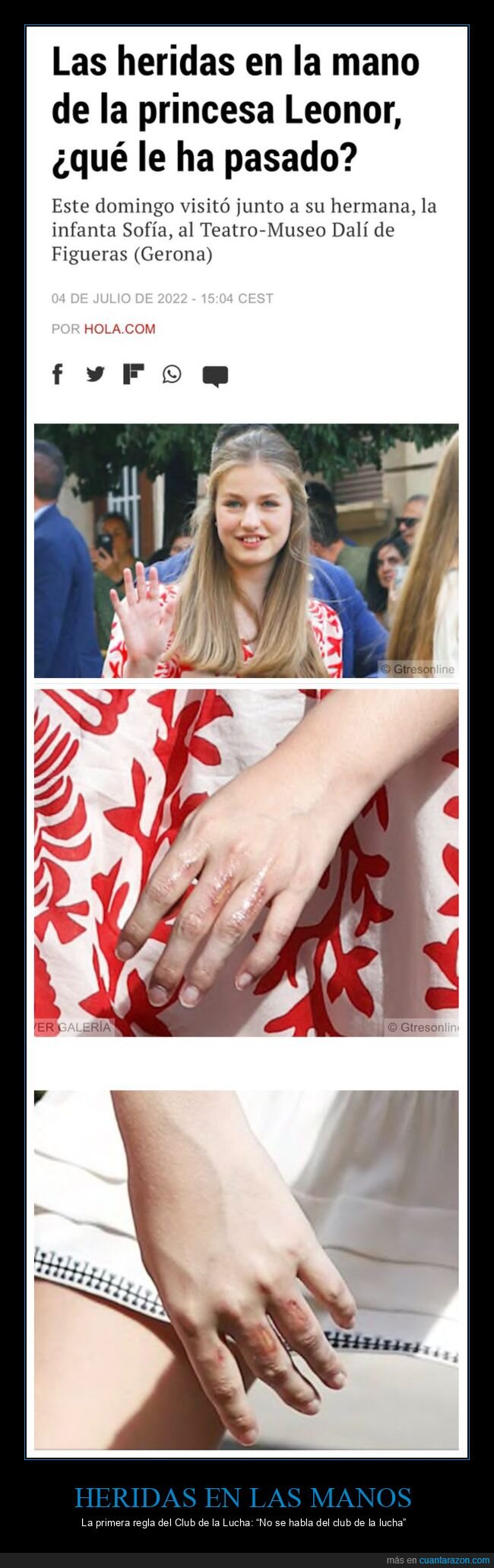 el club de la lucha,heridas,mano,princesa leonor