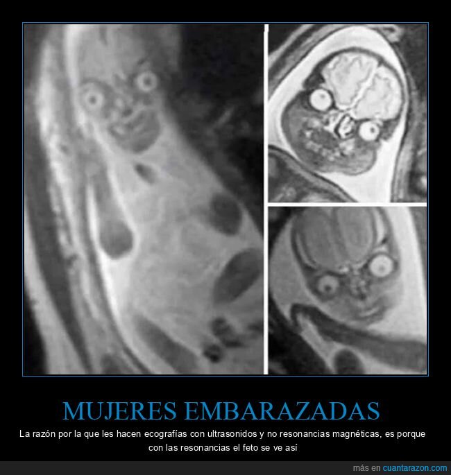 curiosidades,ecografías,embarazadas,feto,resonancias magnéticas