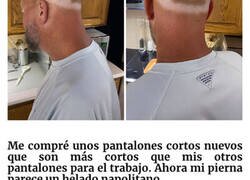 Enlace a Personas que no se pusieron protector solar y acabaron pareciendo imbéciles