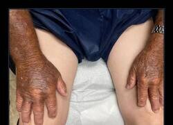 Enlace a Lo que hace el sol en nuestra piel