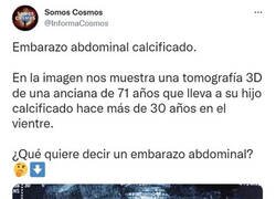 Enlace a Rarezas del cuerpo humano