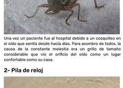 Enlace a Cosas de infarto que los médicos han llegado a sacar de los oídos de sus pacientes