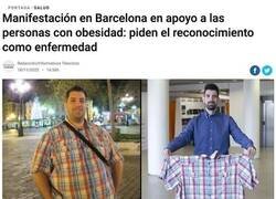Enlace a Obesos piden reconocimiento como enfermedad