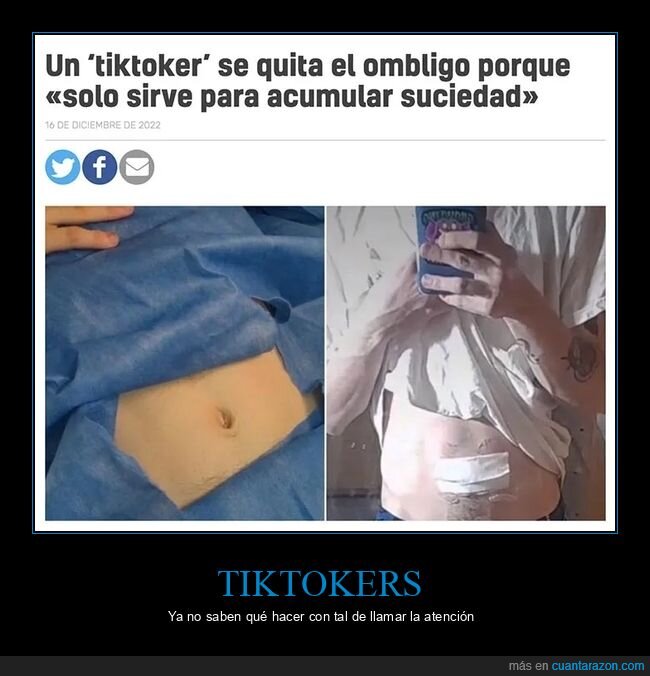 ombligo,quitar,wtf
