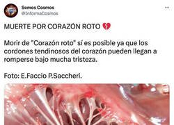 Enlace a ¿Sabías que es posible morir por corazón roto?