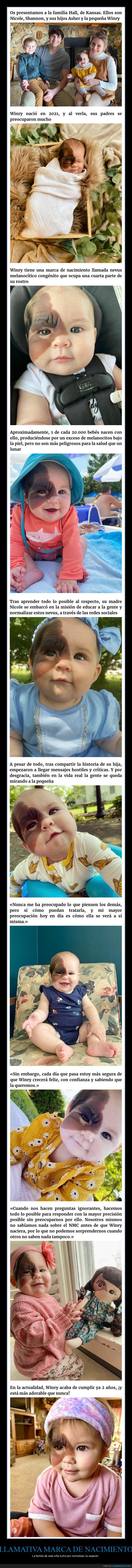 marca de nacimiento,cara,niña