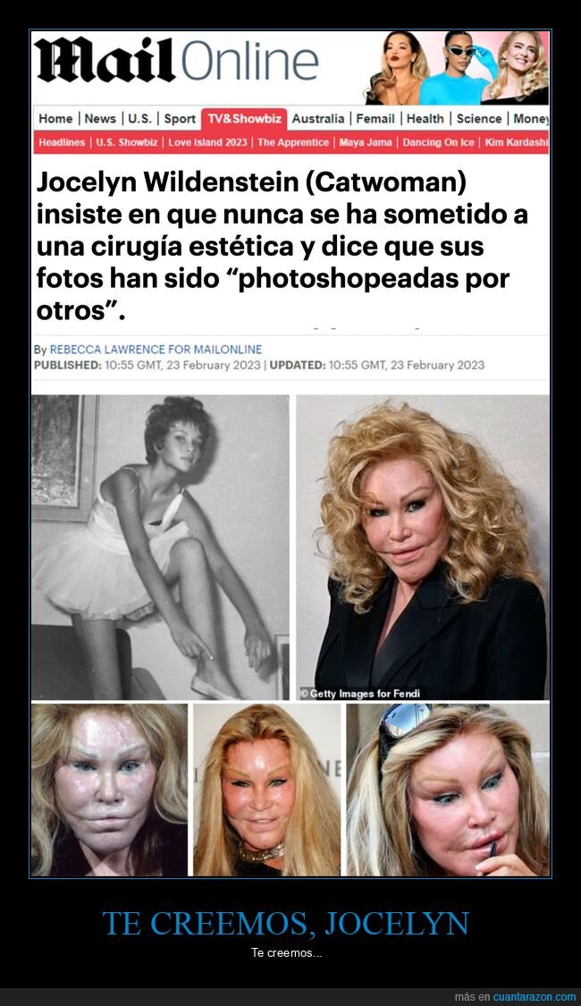 jocelyn wildenstein,cirugías,wtf