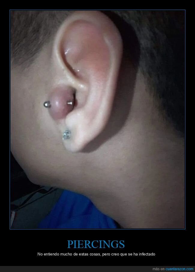 fails,oreja,piercing