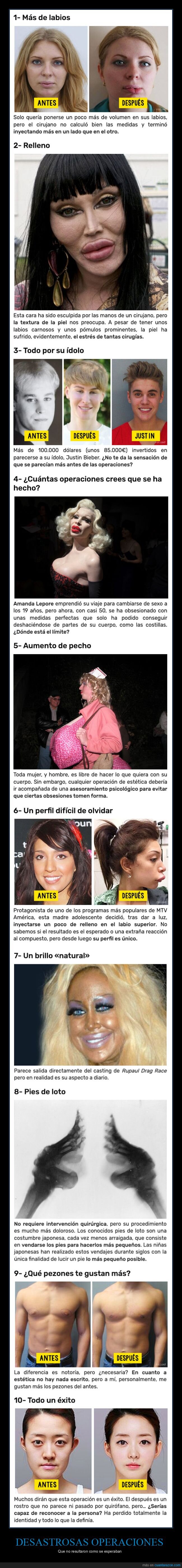 operaciones,cirugía estética,fails