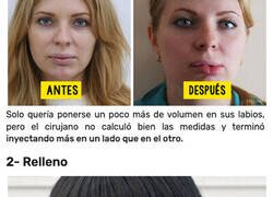 Enlace a Desastrosas operaciones de cirugía estética que no resultaron como se esperaba