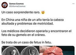 Enlace a Sorpresa médica