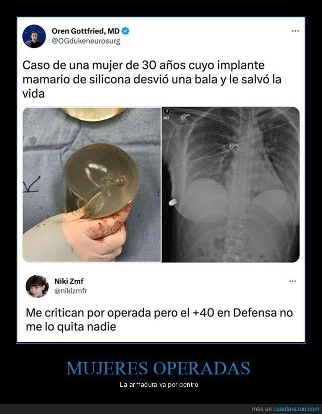 bala,implante mamario,salvar