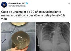 Enlace a Salvada por la prótesis