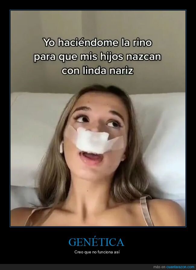 hijos,nariz,rinoplastia