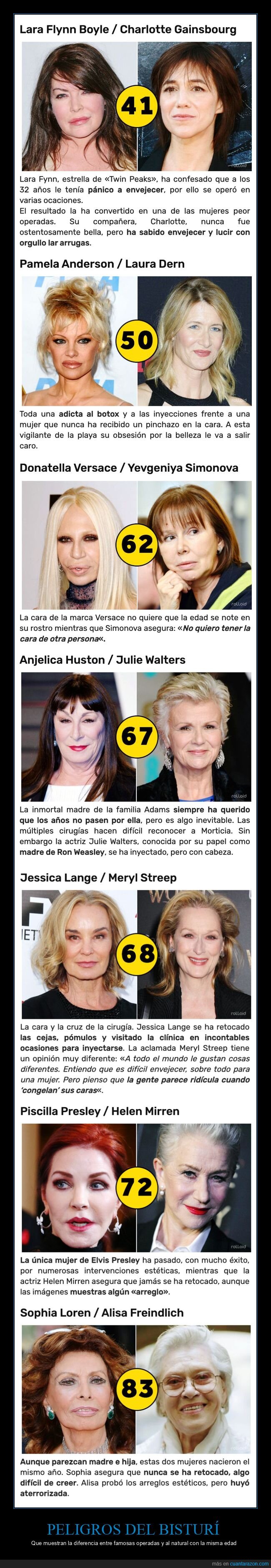 operaciones,famosas,edad