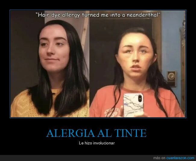 alergia,caretos,pelo,tinte