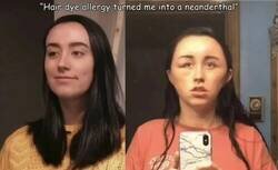 Enlace a Alergias que te convierten en neandertal