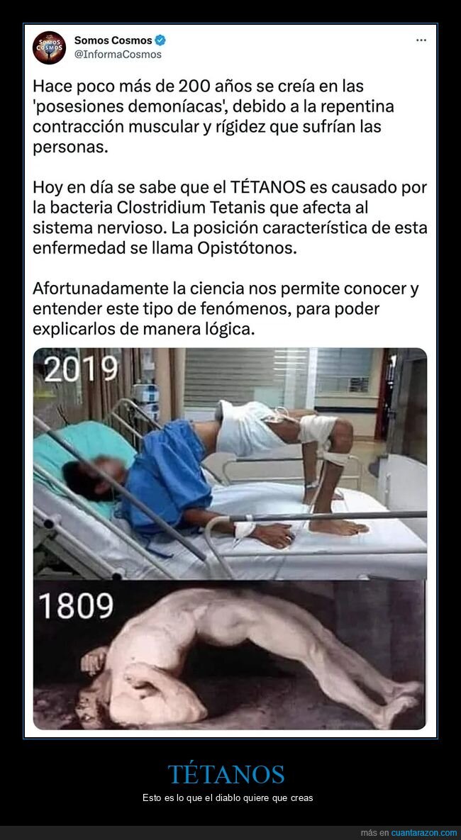 contracción muscular,curiosidades,posesiones,tétanos