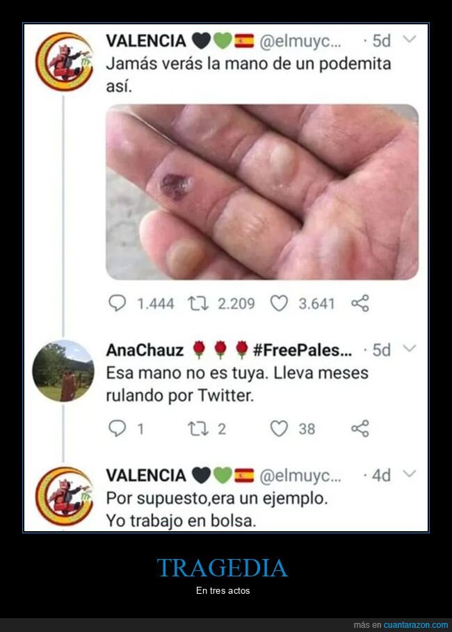 fails,mano,zasca