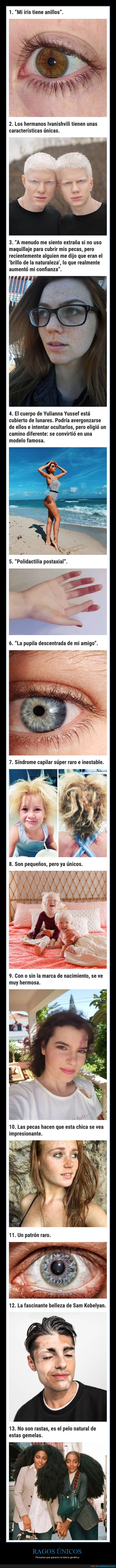 genética,rasgos,únicos