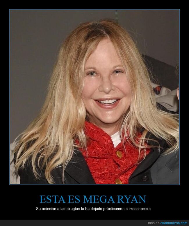 meg ryan,cirugías