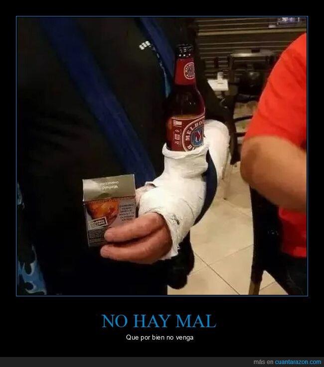 cerveza,escayola,wtf