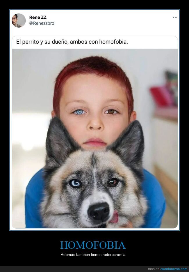 heterocromía,homofobia,ojos