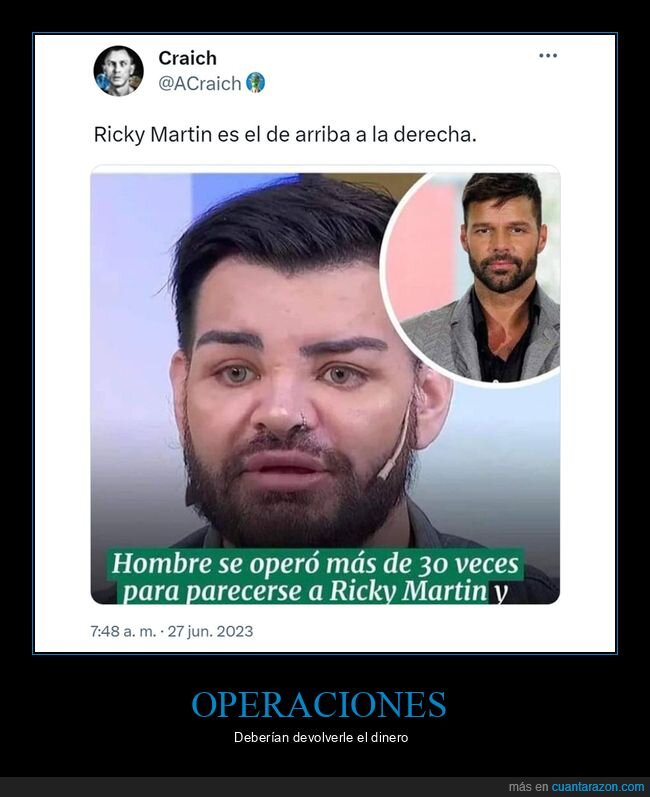 ricky martin,operaciones,parecerse