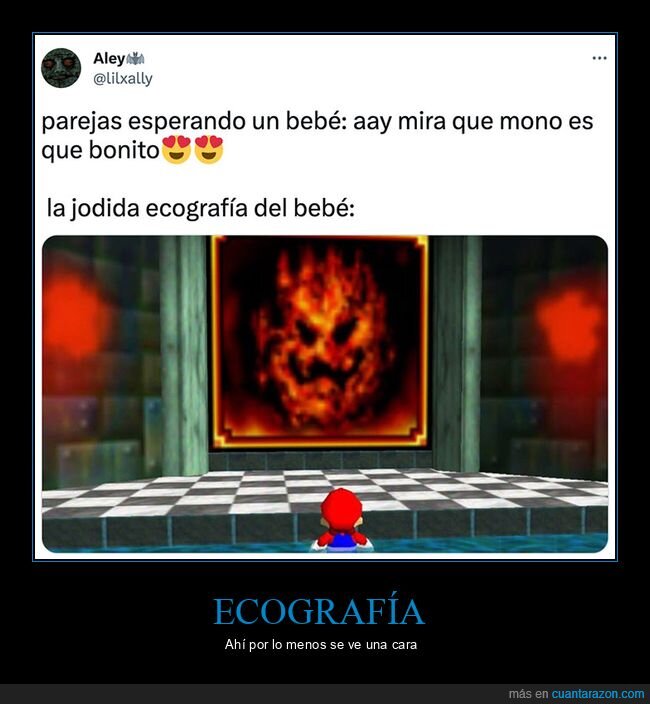 bebé,ecografía,mario