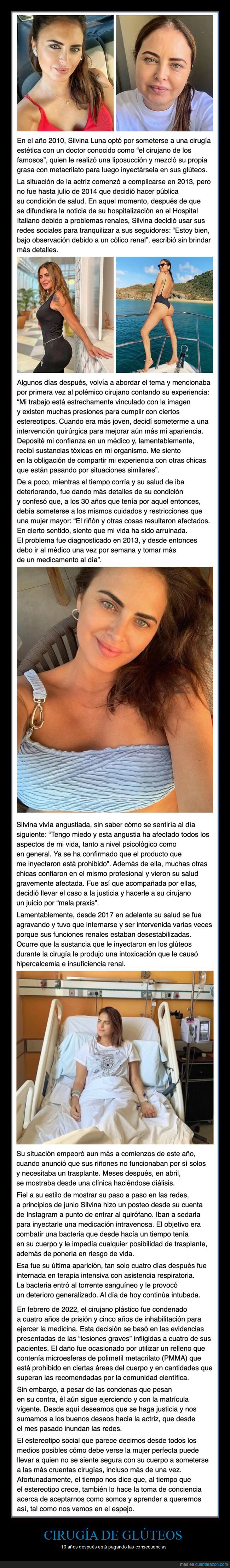 cirugía,glúteos,fails