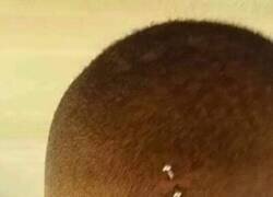 Enlace a Piercing de nuca