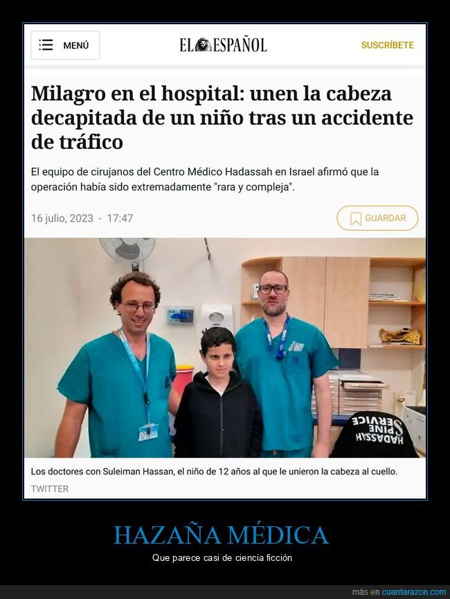 cabeza,decapitada,niño,médicos