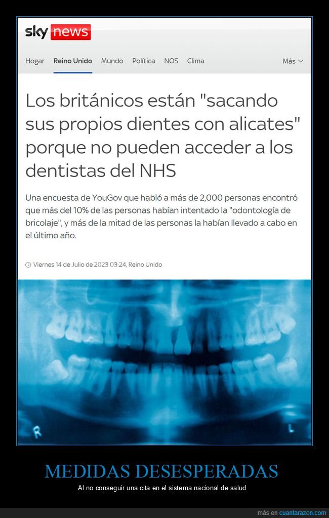 británicos,sacando,dientes,alicates,dentistas